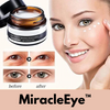 MiracleEye™ - Wrinkle Eraser Firming Eye Cream [Last day discount]